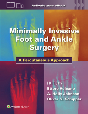 Minimally Invasive Foot and Ankle Surgery: A Percutaneous Approach Minimally Invasive Surgery in Foot and Ankle